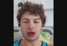 5 месеца условно за полицай, счупил челюстта на студент край Созопол