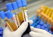 Четирима нови носители на ХИВ в Бургас от началото на годината